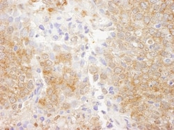 PTEN Antibody, Novus Biologicals 0.1mL; Unlabeled:Antibodies, Polyclonal